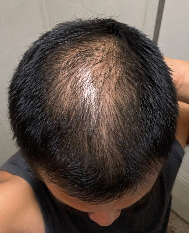 Before treatment